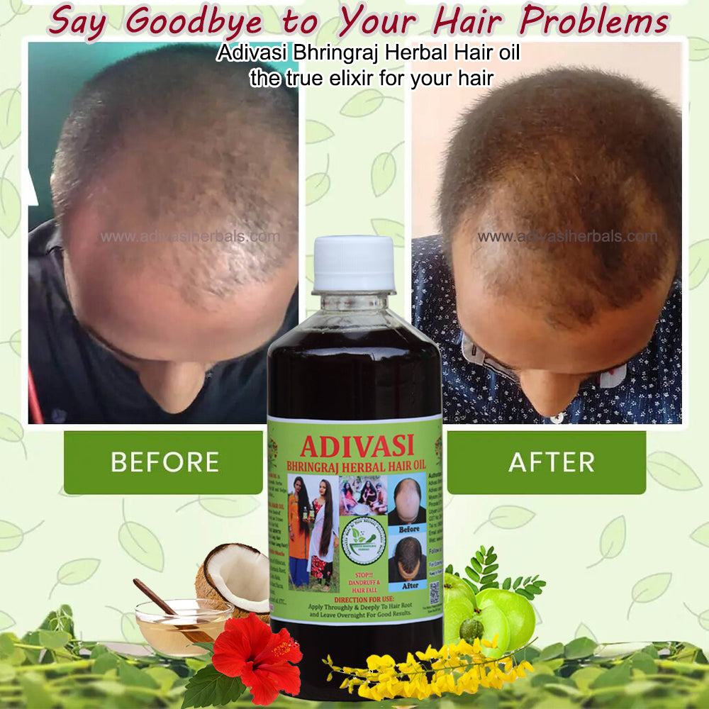 Adivasi Bhringraj Herbal Hair Oil (with adivasi traditional ayurvedic technique)